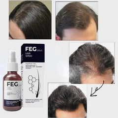 FEG PLUS Hair & Beard Growth Serum Spray